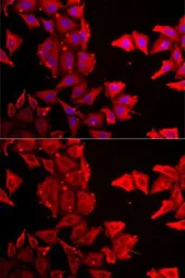 Anti-THRSP antibody used in Immunocytochemistry/ Immunofluorescence (ICC/IF). GTX32922