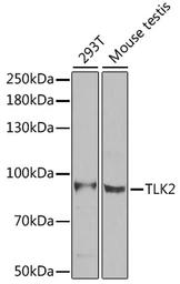 Anti-TLK2 antibody used in Western Blot (WB). GTX32923
