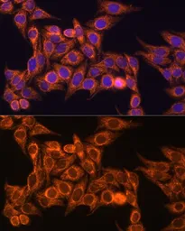 Anti-TOMM20 antibody used in Immunocytochemistry/ Immunofluorescence (ICC/IF). GTX32928