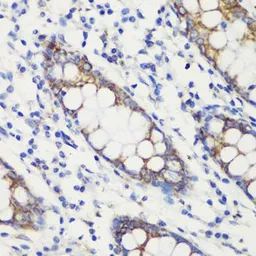 Anti-TOMM20 antibody used in IHC (Paraffin sections) (IHC-P). GTX32928