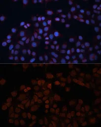 Anti-TOM70 antibody used in Immunocytochemistry/ Immunofluorescence (ICC/IF). GTX32929