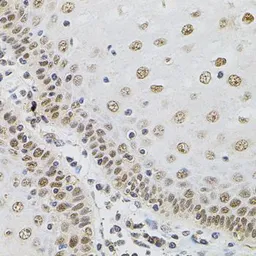 Anti-Transglutaminase 2 antibody used in IHC (Paraffin sections) (IHC-P). GTX32934