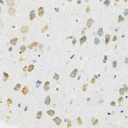 Anti-Transglutaminase 2 antibody used in IHC (Paraffin sections) (IHC-P). GTX32934