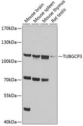 Anti-TUBGCP3 antibody used in Western Blot (WB). GTX32942