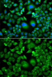Anti-UBE2H antibody used in Immunocytochemistry/ Immunofluorescence (ICC/IF). GTX32944