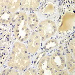 Anti-UBE2Z antibody used in IHC (Paraffin sections) (IHC-P). GTX32945