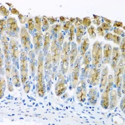 Anti-UQCR10 antibody used in IHC (Paraffin sections) (IHC-P). GTX32954