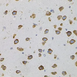 Anti-VEGFC antibody used in IHC (Paraffin sections) (IHC-P). GTX32962