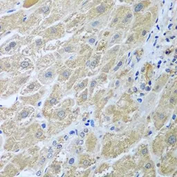 Anti-WDR48 antibody used in IHC (Paraffin sections) (IHC-P). GTX32970