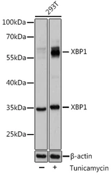 Anti-XBP1 antibody used in Western Blot (WB). GTX32974