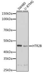 Anti-5-HT2B receptor antibody used in Western Blot (WB). GTX32984