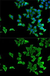 Anti-5-HT2B receptor antibody used in Immunocytochemistry/ Immunofluorescence (ICC/IF). GTX32984