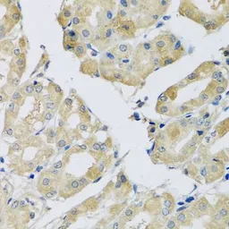 Anti-ABCF2 antibody used in IHC (Paraffin sections) (IHC-P). GTX32985