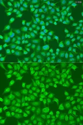 Anti-ACOX1 antibody used in Immunocytochemistry/ Immunofluorescence (ICC/IF). GTX32989