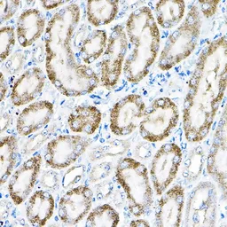 Anti-ACOX1 antibody used in IHC (Paraffin sections) (IHC-P). GTX32989