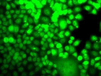 Anti-ALOX15B antibody used in Immunocytochemistry/ Immunofluorescence (ICC/IF). GTX33001