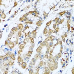 Anti-ANTXR2 antibody used in IHC (Paraffin sections) (IHC-P). GTX33011