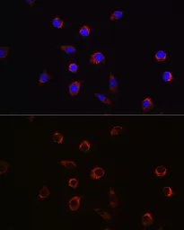 Anti-APLP2 antibody used in Immunocytochemistry/ Immunofluorescence (ICC/IF). GTX33014