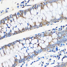 Anti-Apolipoprotein M antibody used in IHC (Paraffin sections) (IHC-P). GTX33015