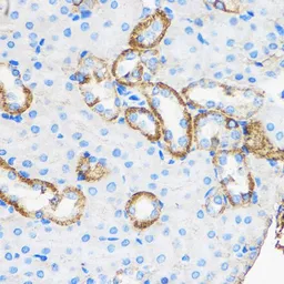 Anti-Apolipoprotein M antibody used in IHC (Paraffin sections) (IHC-P). GTX33015