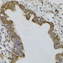 Anti-ARHGEF11 antibody used in IHC (Paraffin sections) (IHC-P). GTX33017