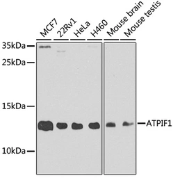 Anti-ATPIF1 antibody used in Western Blot (WB). GTX33029