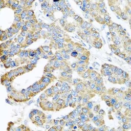 Anti-ATPIF1 antibody used in IHC (Paraffin sections) (IHC-P). GTX33029