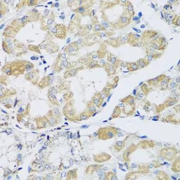 Anti-ATPIF1 antibody used in IHC (Paraffin sections) (IHC-P). GTX33029