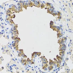 Anti-B9D1 antibody used in IHC (Paraffin sections) (IHC-P). GTX33030