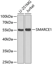 Anti-BAF57 antibody used in Western Blot (WB). GTX33031