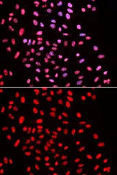 Anti-BAF57 antibody used in Immunocytochemistry/ Immunofluorescence (ICC/IF). GTX33031