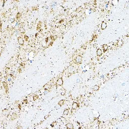 Anti-BCAT2 antibody used in IHC (Paraffin sections) (IHC-P). GTX33036