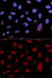 Anti-Cardiac Troponin C antibody used in Immunocytochemistry/ Immunofluorescence (ICC/IF). GTX33061