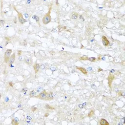 Anti-CBR4 antibody used in IHC (Paraffin sections) (IHC-P). GTX33068