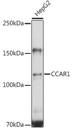 Anti-CCAR1 antibody used in Western Blot (WB). GTX33069