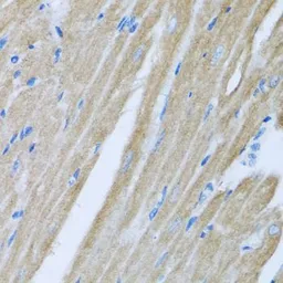 Anti-CCM2 antibody used in IHC (Paraffin sections) (IHC-P). GTX33071