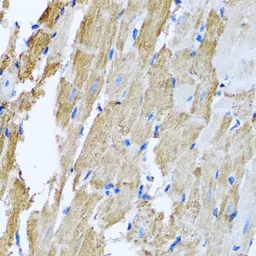 Anti-CCM2 antibody used in IHC (Paraffin sections) (IHC-P). GTX33071