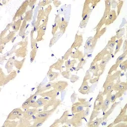 Anti-TCP1 gamma antibody used in IHC (Paraffin sections) (IHC-P). GTX33073