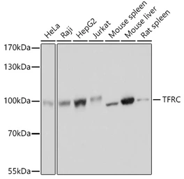Anti-CD71 antibody used in Western Blot (WB). GTX33080