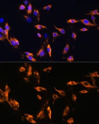 Anti-CD71 antibody used in Immunocytochemistry/ Immunofluorescence (ICC/IF). GTX33080