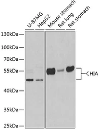 Anti-CHIA antibody used in Western Blot (WB). GTX33093
