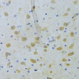 Anti-CHIA antibody used in IHC (Paraffin sections) (IHC-P). GTX33093