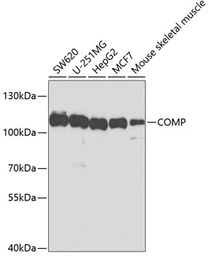 Anti-COMP antibody used in Western Blot (WB). GTX33106