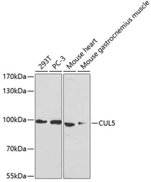 Anti-Cullin 5 antibody used in Western Blot (WB). GTX33130