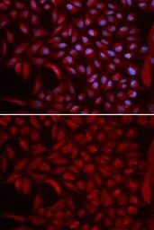 Anti-Cullin 5 antibody used in Immunocytochemistry/ Immunofluorescence (ICC/IF). GTX33130