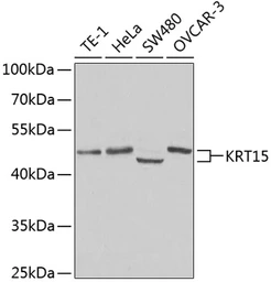 Anti-Cytokeratin 15 antibody used in Western Blot (WB). GTX33139