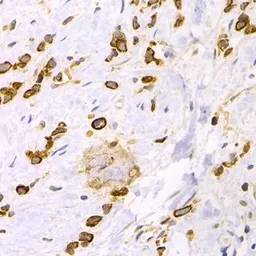 Anti-Cytokeratin 15 antibody used in IHC (Paraffin sections) (IHC-P). GTX33139
