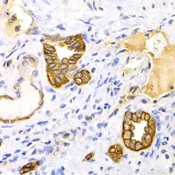 Anti-Cytokeratin 15 antibody used in IHC (Paraffin sections) (IHC-P). GTX33139