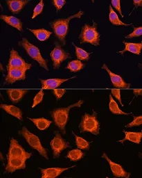 Anti-DAAM2 antibody used in Immunocytochemistry/ Immunofluorescence (ICC/IF). GTX33141