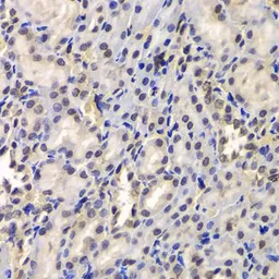 Anti-DDX41 antibody used in IHC (Paraffin sections) (IHC-P). GTX33151